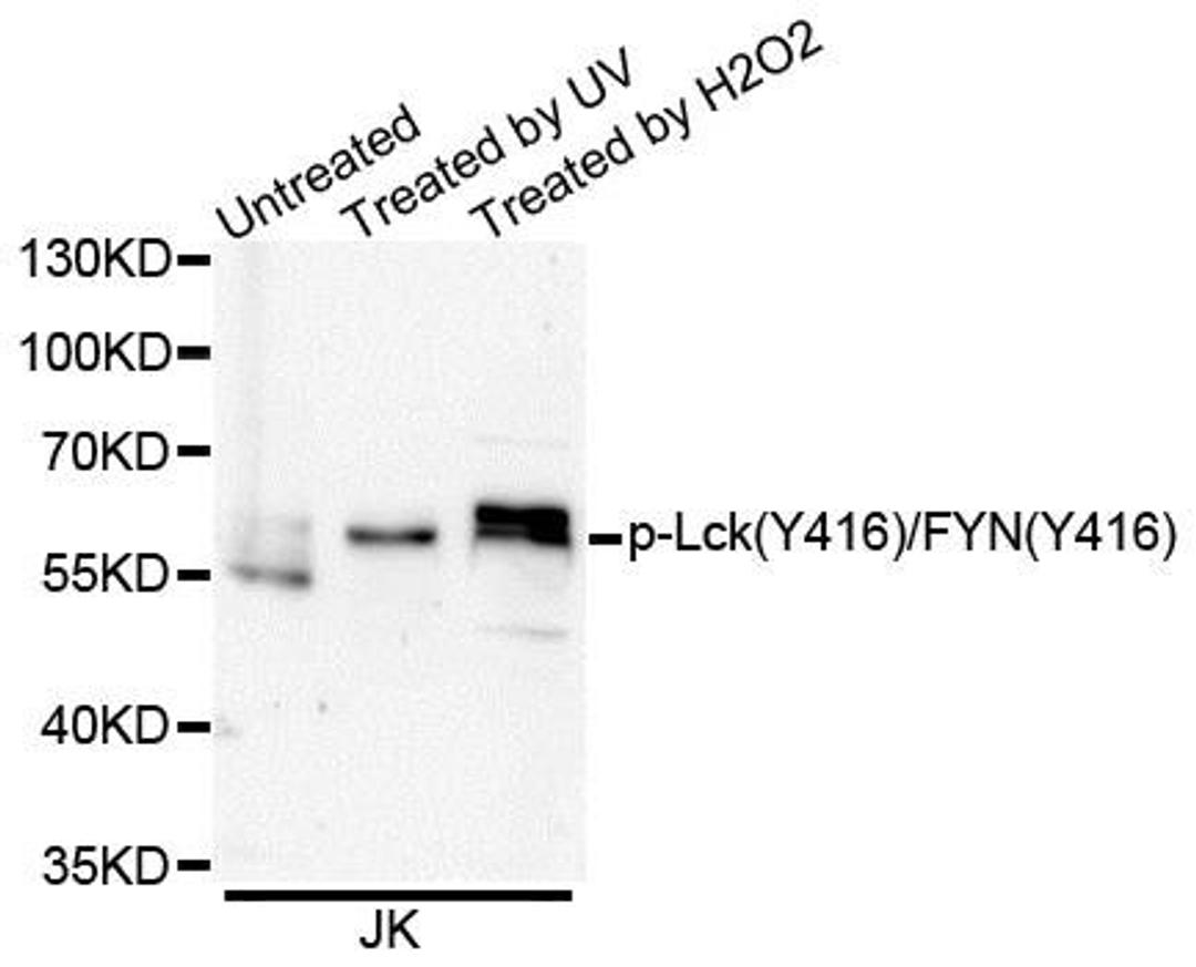 Western blot analysis of extracts of Jurkat cells using Lck (Phospho-Y416/FYN-Y416) antibody