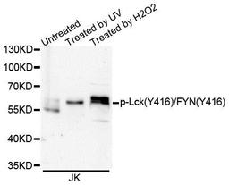 Western blot analysis of extracts of Jurkat cells using Lck (Phospho-Y416/FYN-Y416) antibody