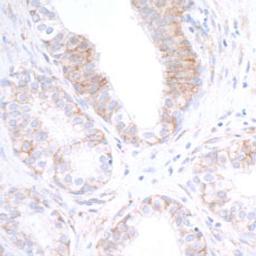 Detection of human Nectin-2/CD112 by immunohistochemistry.