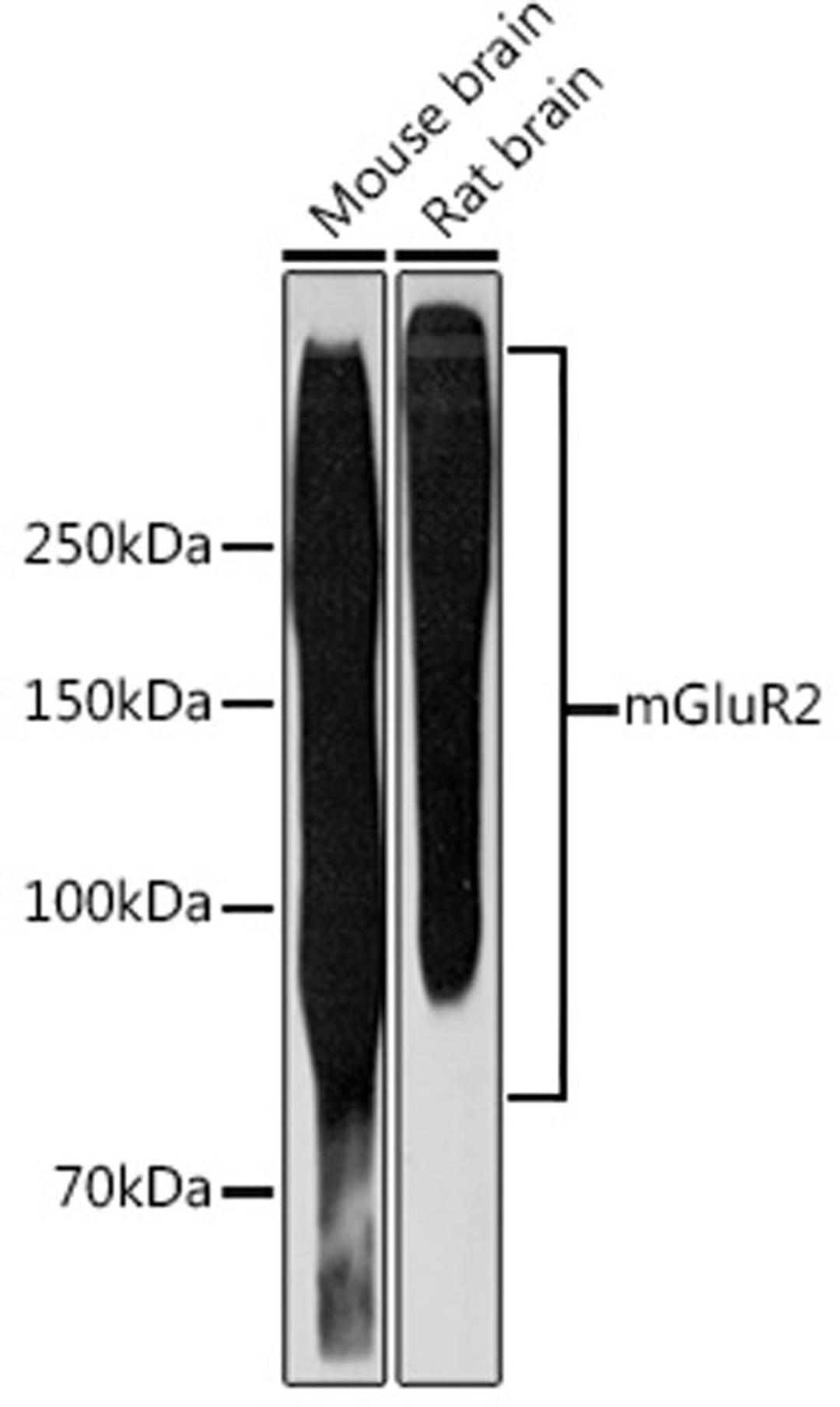 Western blot - mGluR2 Rabbit mAb (A3673)