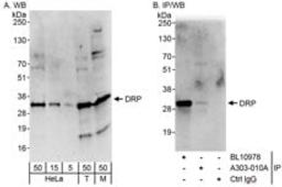 Detection of human and mouse DRP by western blot (h&m) and immunoprecipitation (h).