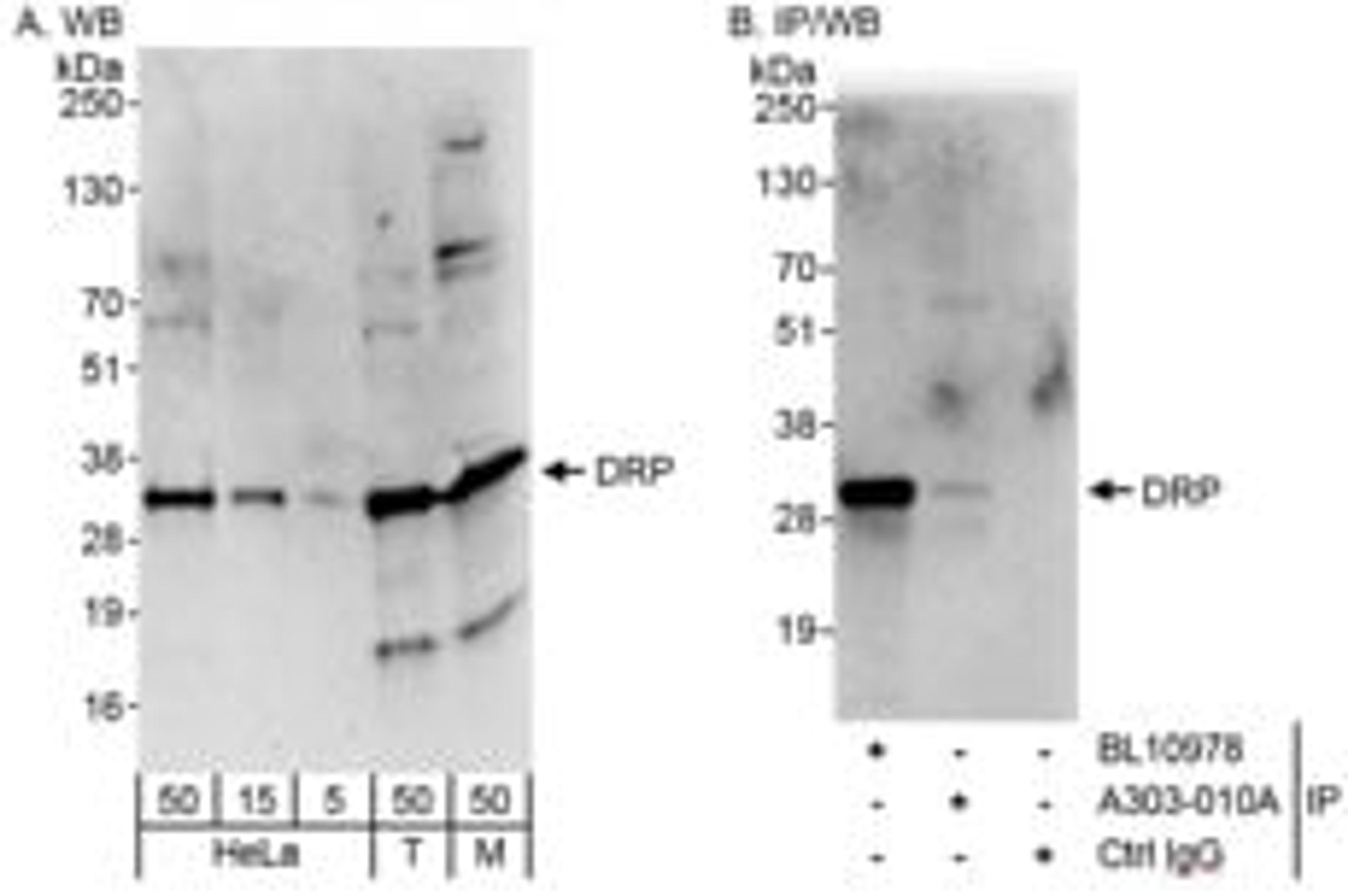 Detection of human and mouse DRP by western blot (h&m) and immunoprecipitation (h).