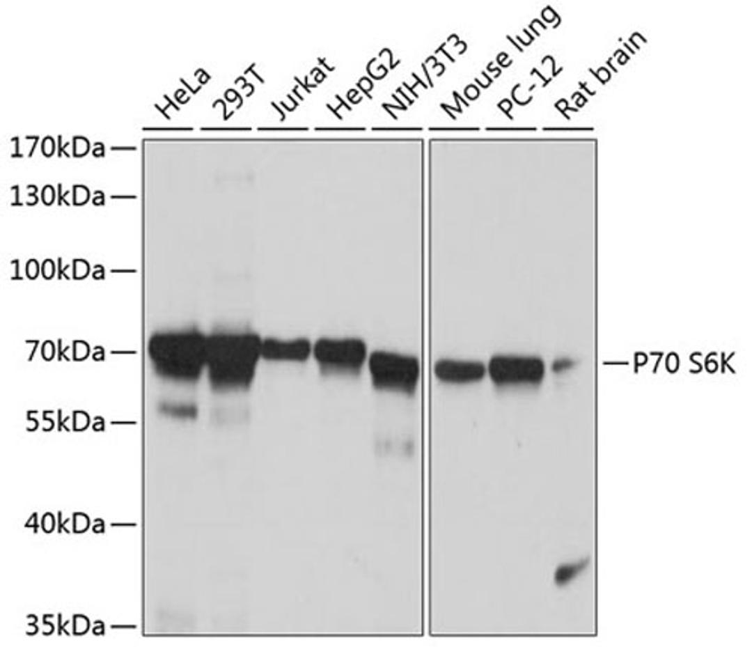 Western blot - P70 S6K antibody (A16658)