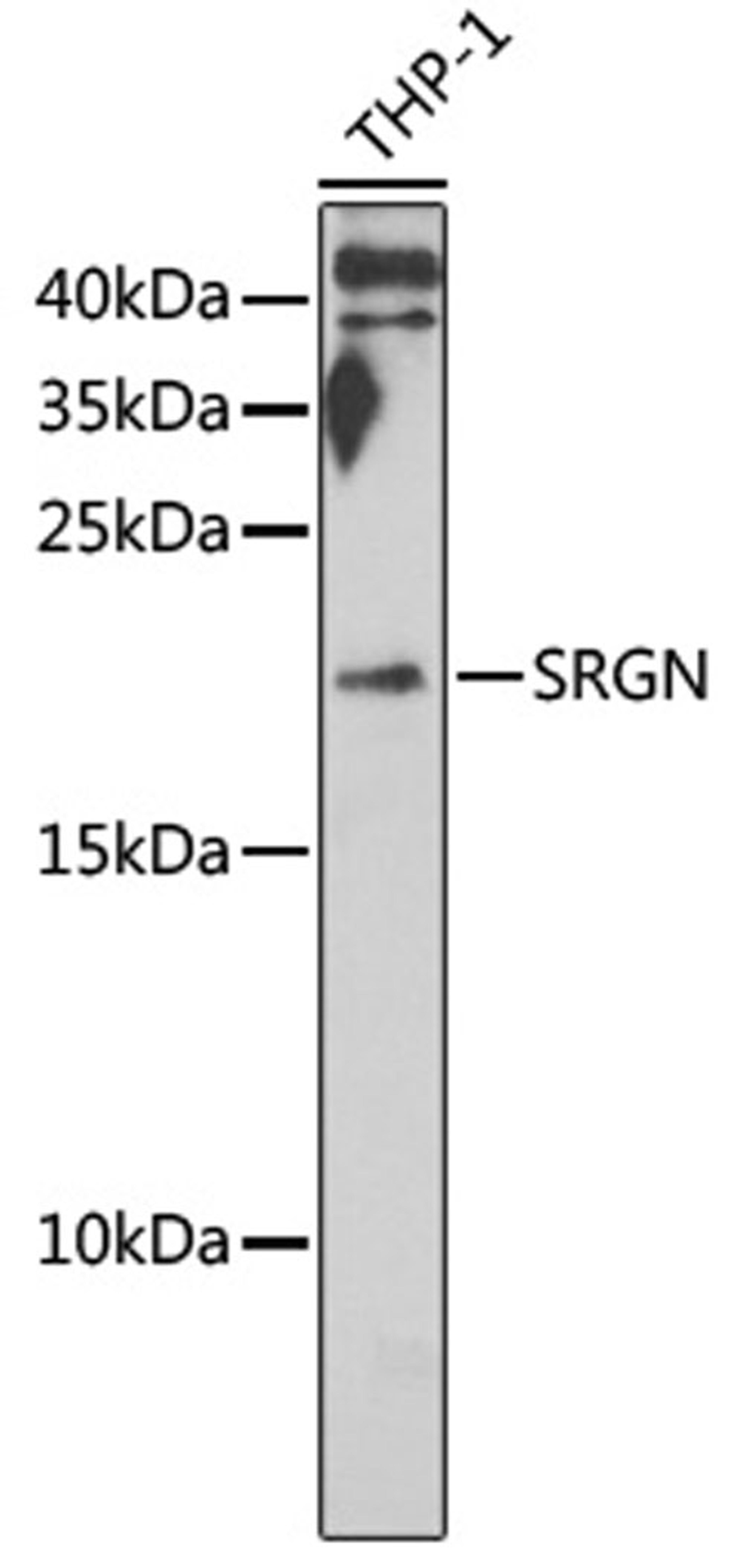 Western blot - SRGN antibody (A6951)