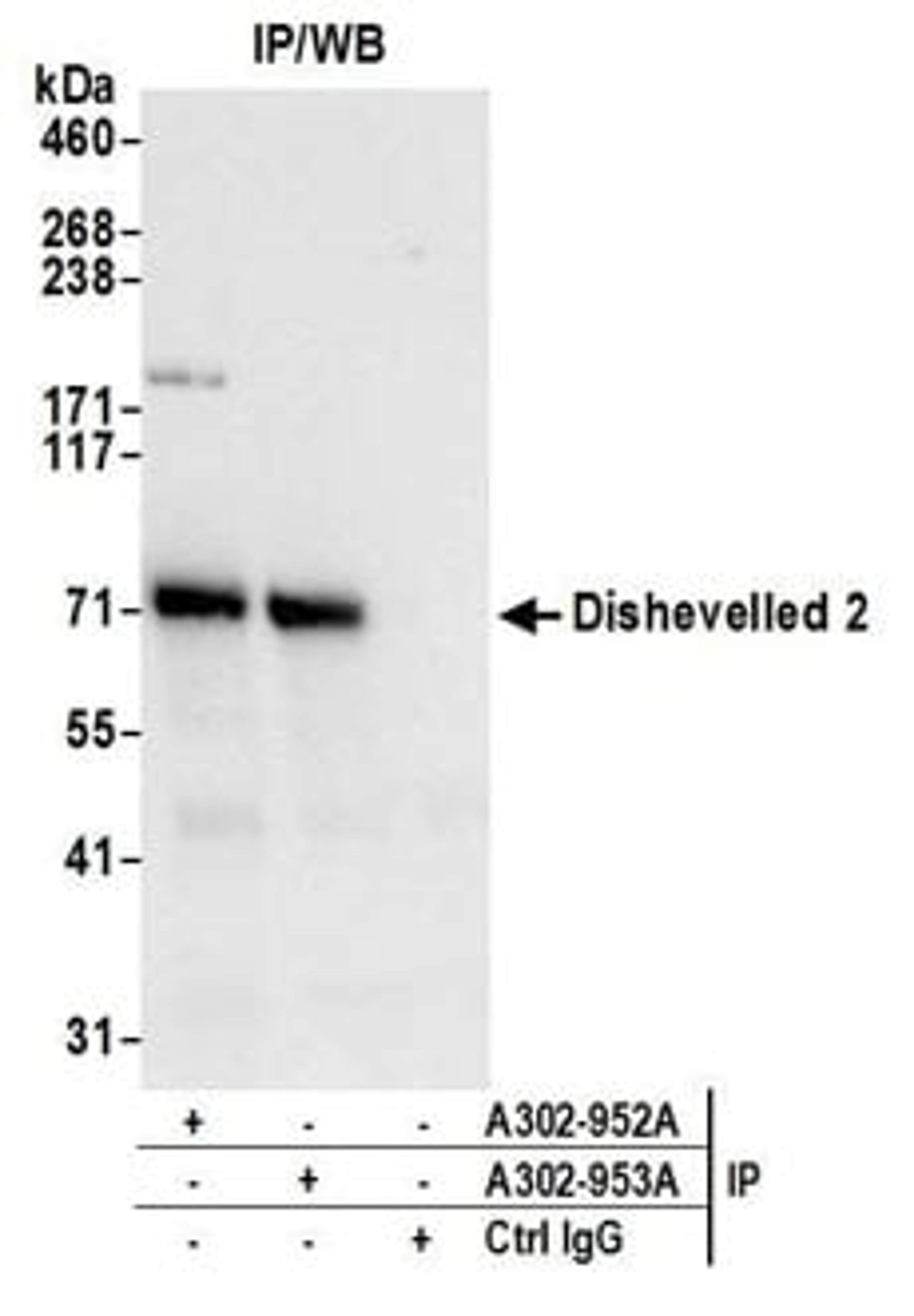 Detection of human Dishevelled 2 by western blot of immunoprecipitates.