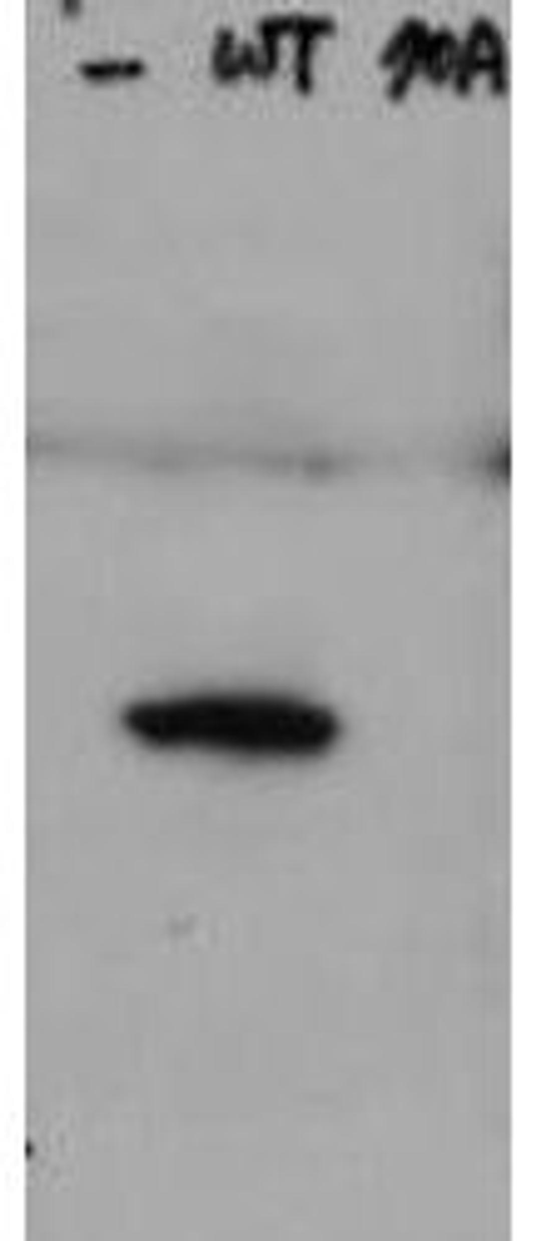 Western blot analysis of Lane 1: HeLa cell extracts of untransfected cells (-). Lane 2: transfected HeLa cell extracts with Flag X3-Hice1 WT (WT). Lane 3: transfected HeLa cell extracts with Flag X3-Hice1 S70A mutant (70A). Load: 35 ug per lane using HICE