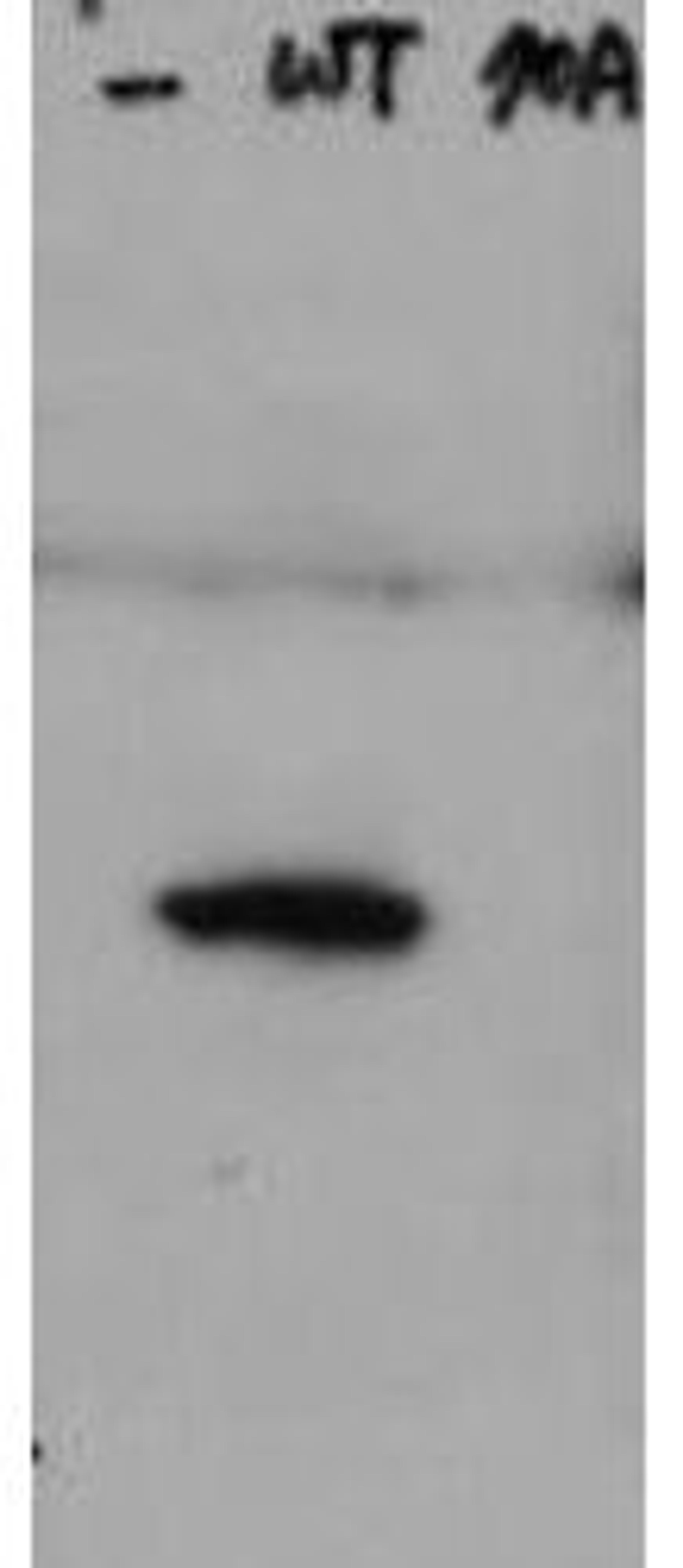 Western blot analysis of Lane 1: HeLa cell extracts of untransfected cells (-). Lane 2: transfected HeLa cell extracts with Flag X3-Hice1 WT (WT). Lane 3: transfected HeLa cell extracts with Flag X3-Hice1 S70A mutant (70A). Load: 35 ug per lane using HICE