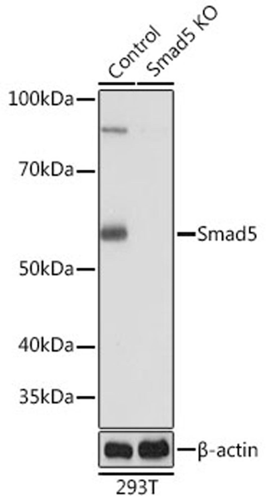 Western blot - Smad5 antibody (A19117)