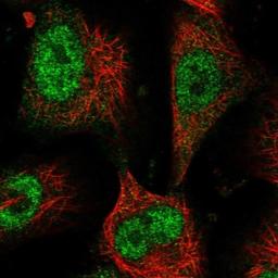 Immunocytochemistry/Immunofluorescence: BICC1 Antibody [NBP1-94171] - Staining of human cell line U-251 MG shows positivity in nucleus but not nucleoli.