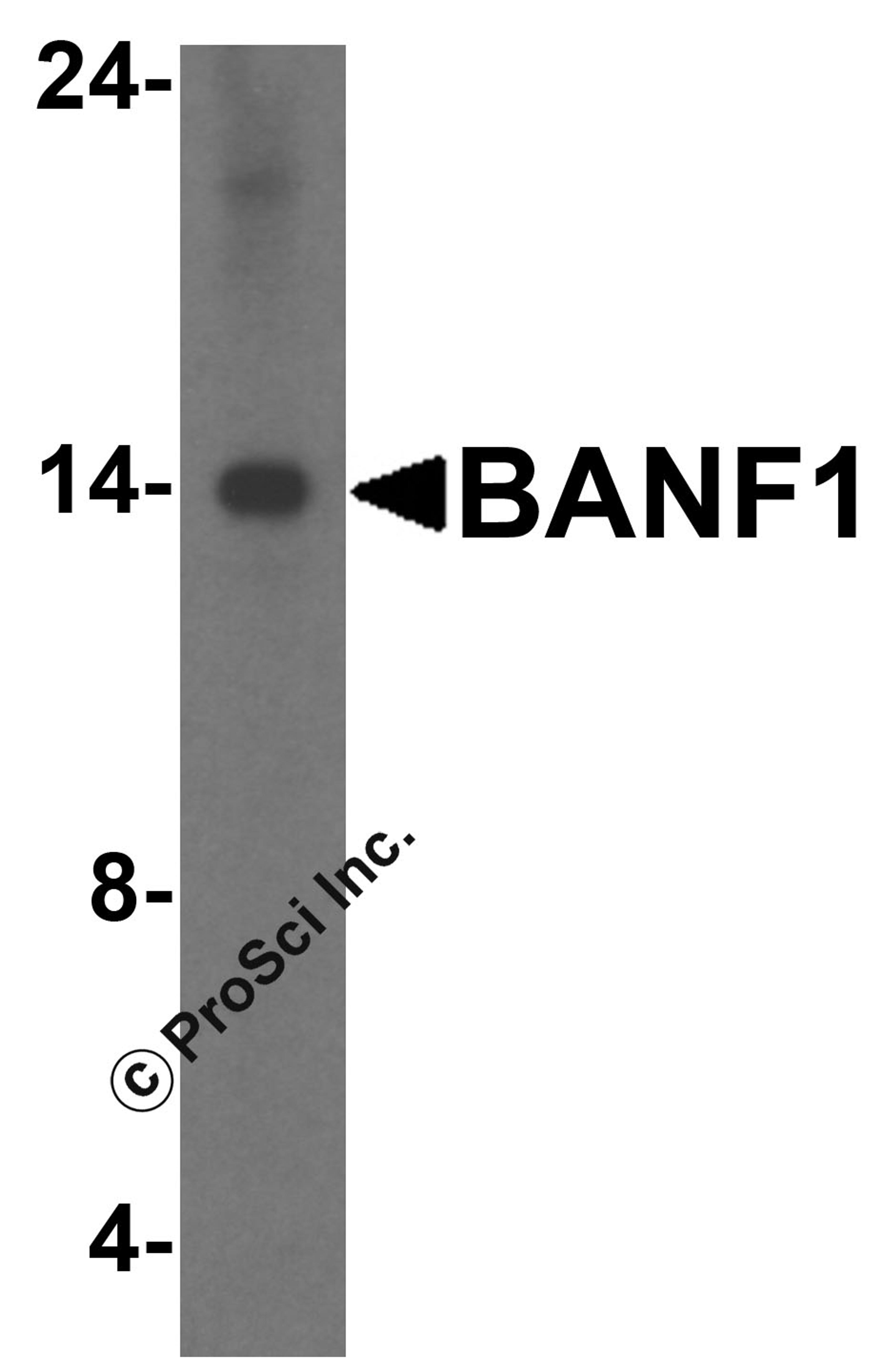 Western blot analysis of BANF1 in Hela cell lysate with BANF1 antibody at 1 μg/mL.