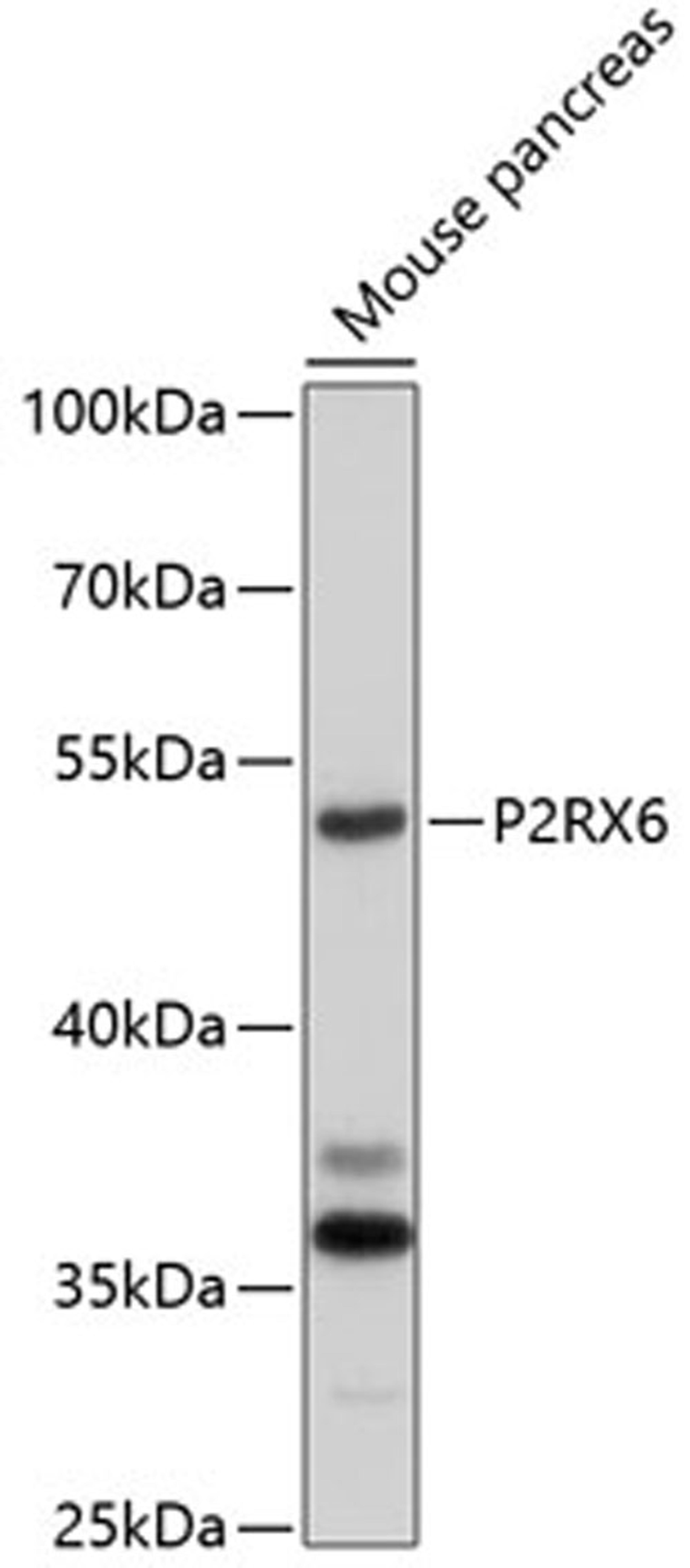 Western blot - P2RX6 antibody (A10131)