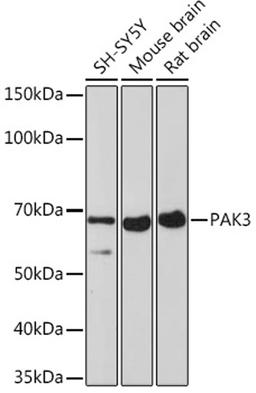 Western blot - PAK3 Rabbit mAb (A3363)