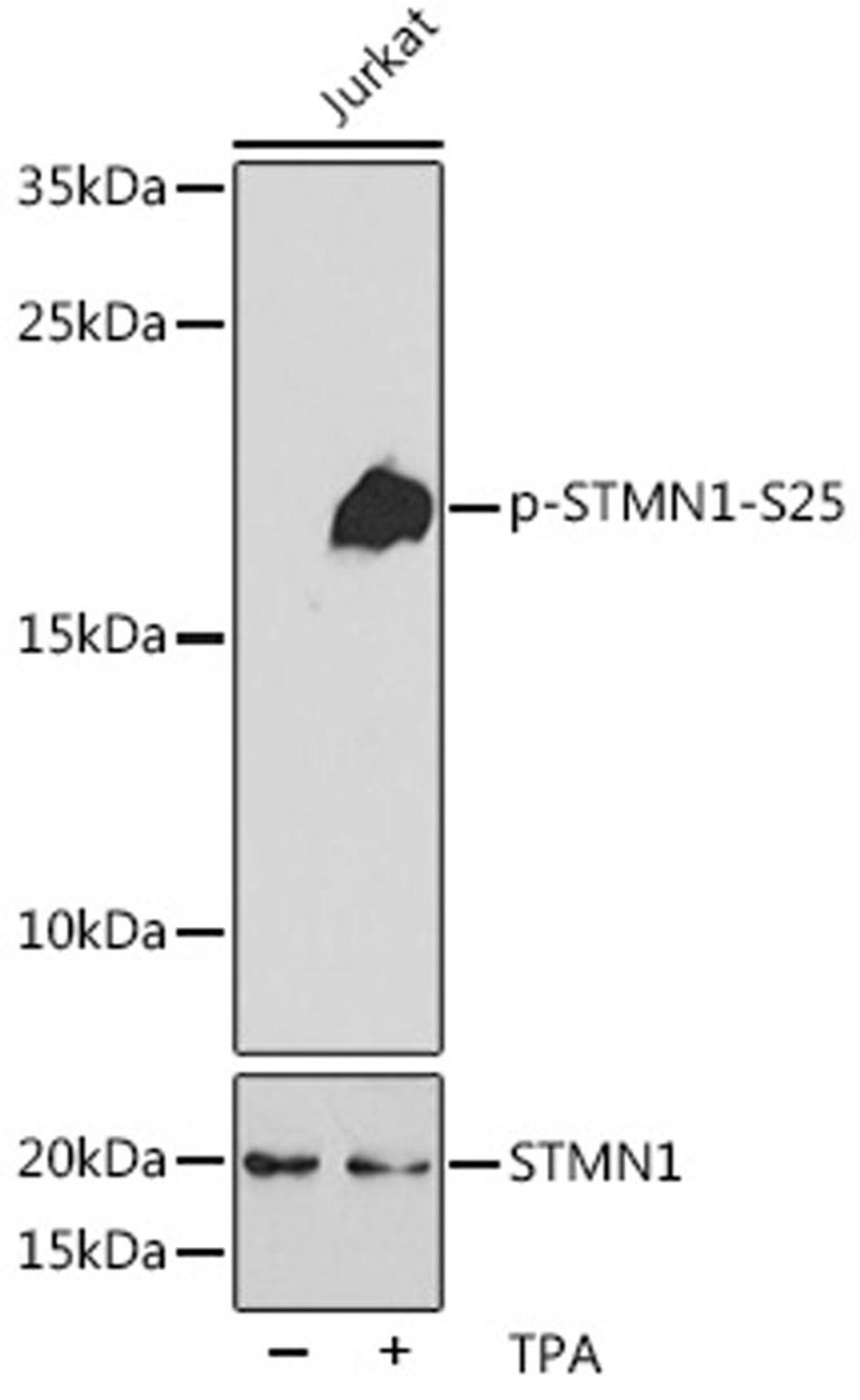 Western blot - Phospho-STMN1-S25 pAb (AP0220)