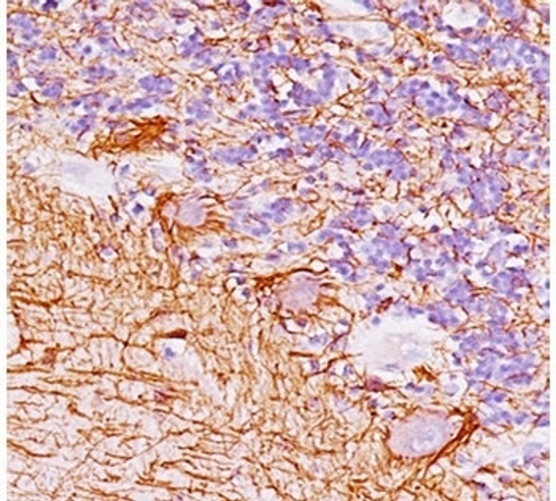 Human cerebellum stained with Neurofilament antibody (NF421).