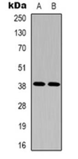 Western blot analysis of EDG5 expression in Hela (Lane 1), A10 (Lane 2) whole cell lysates using S1PR2 antibody