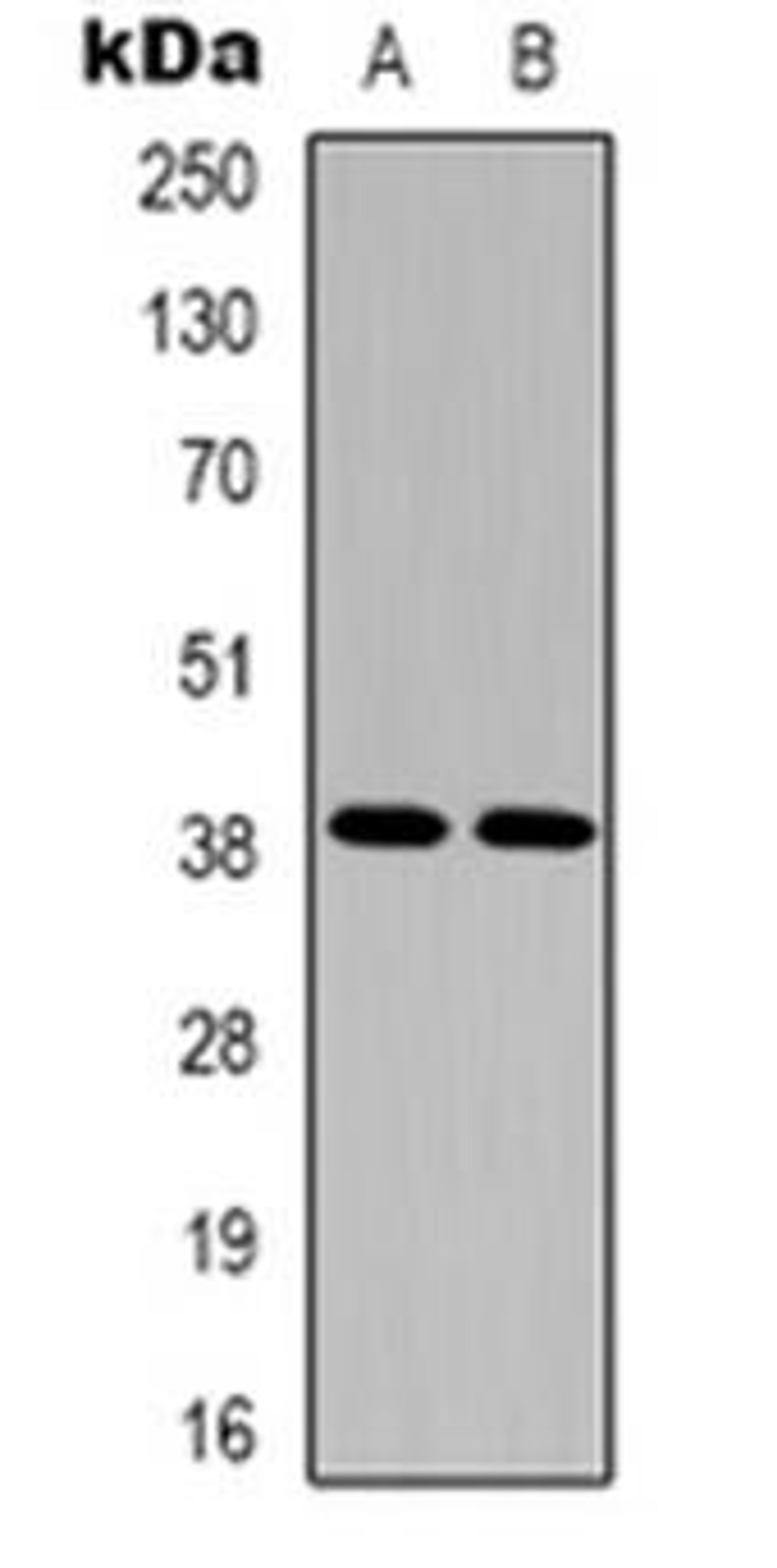 Western blot analysis of EDG5 expression in Hela (Lane 1), A10 (Lane 2) whole cell lysates using S1PR2 antibody