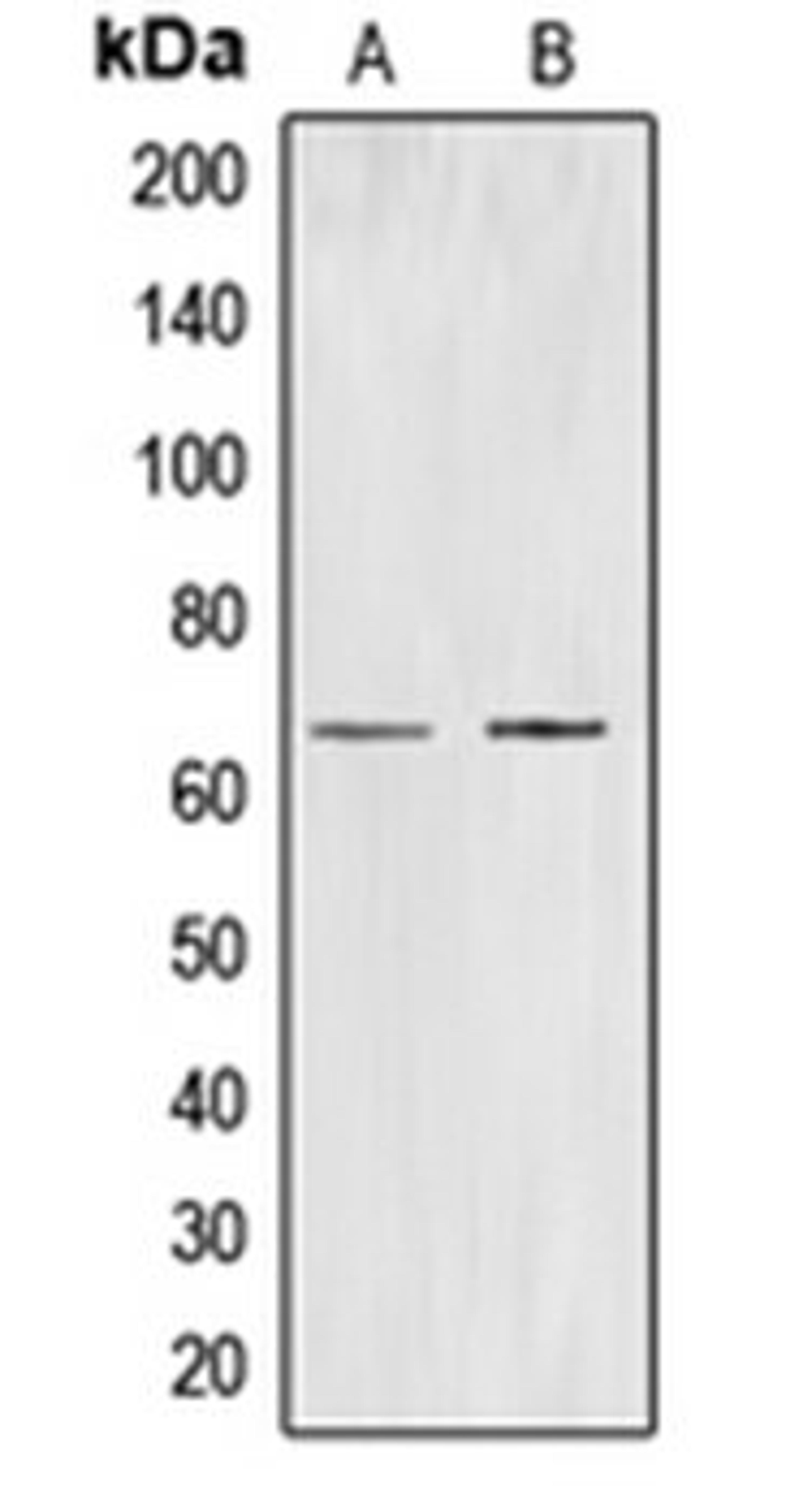 Western blot analysis of K562 (Lane 1), HuvEC (Lane 2) whole cell lysates using CDC40 antibody