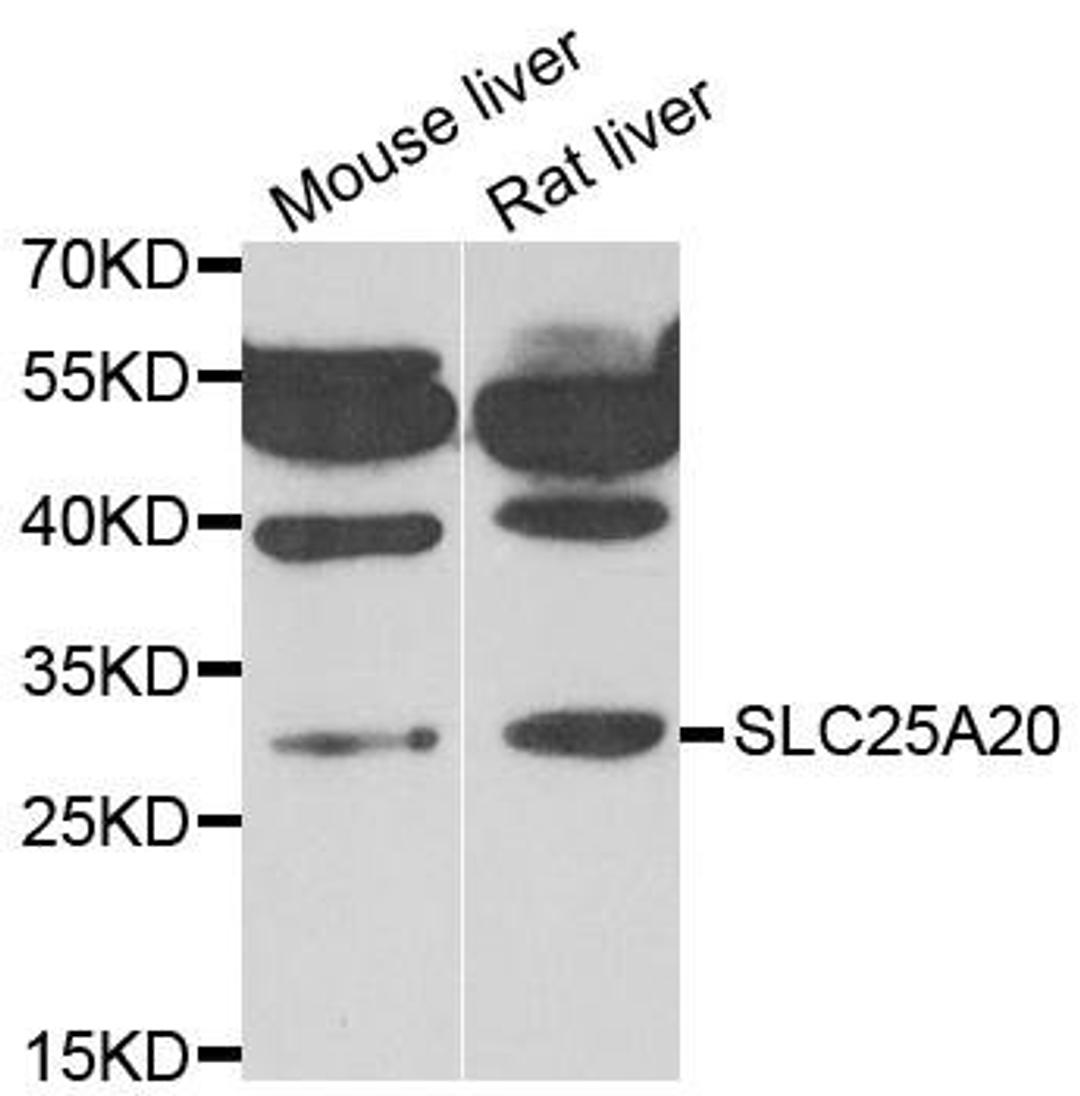 Western blot analysis of extracts of various cell lines using SLC25A20 antibody