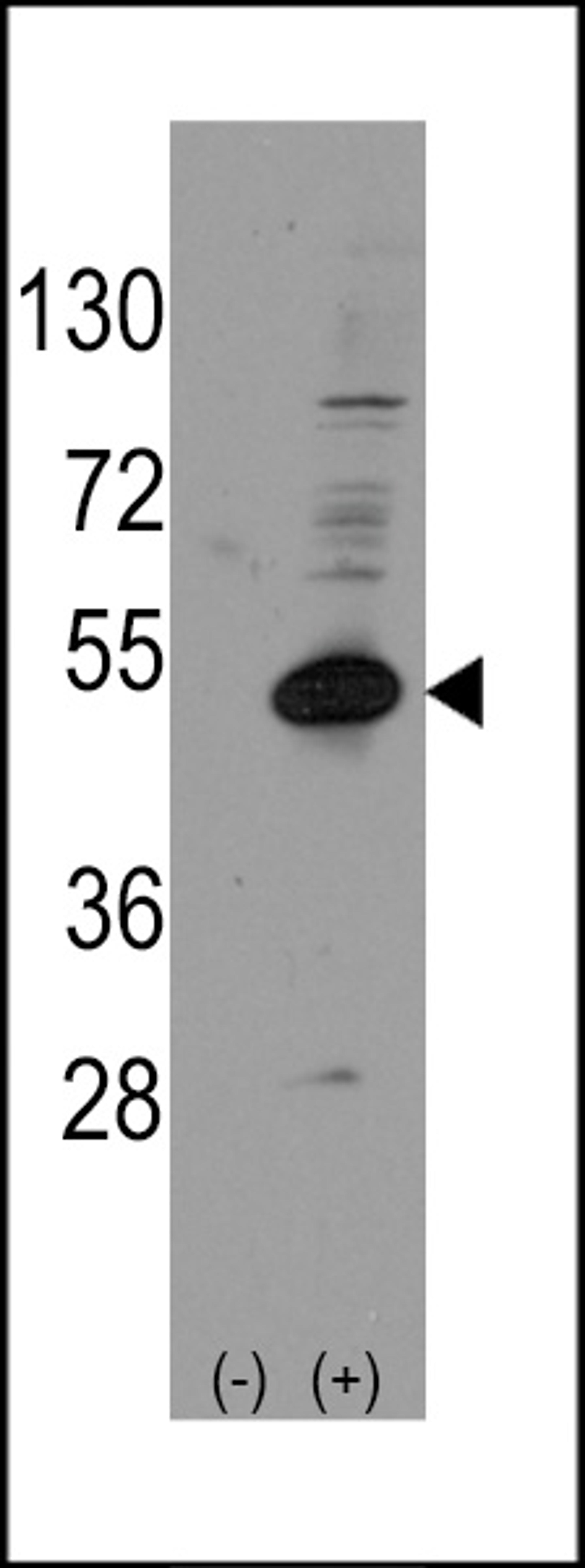 Western blot analysis of NROB1 using rabbit polyclonal NROB1 Antibody (Human C-term) using 293 cell lysates (2 ug/lane) either nontransfected (Lane 1) or transiently transfected with the NROB1 gene (Lane 2).