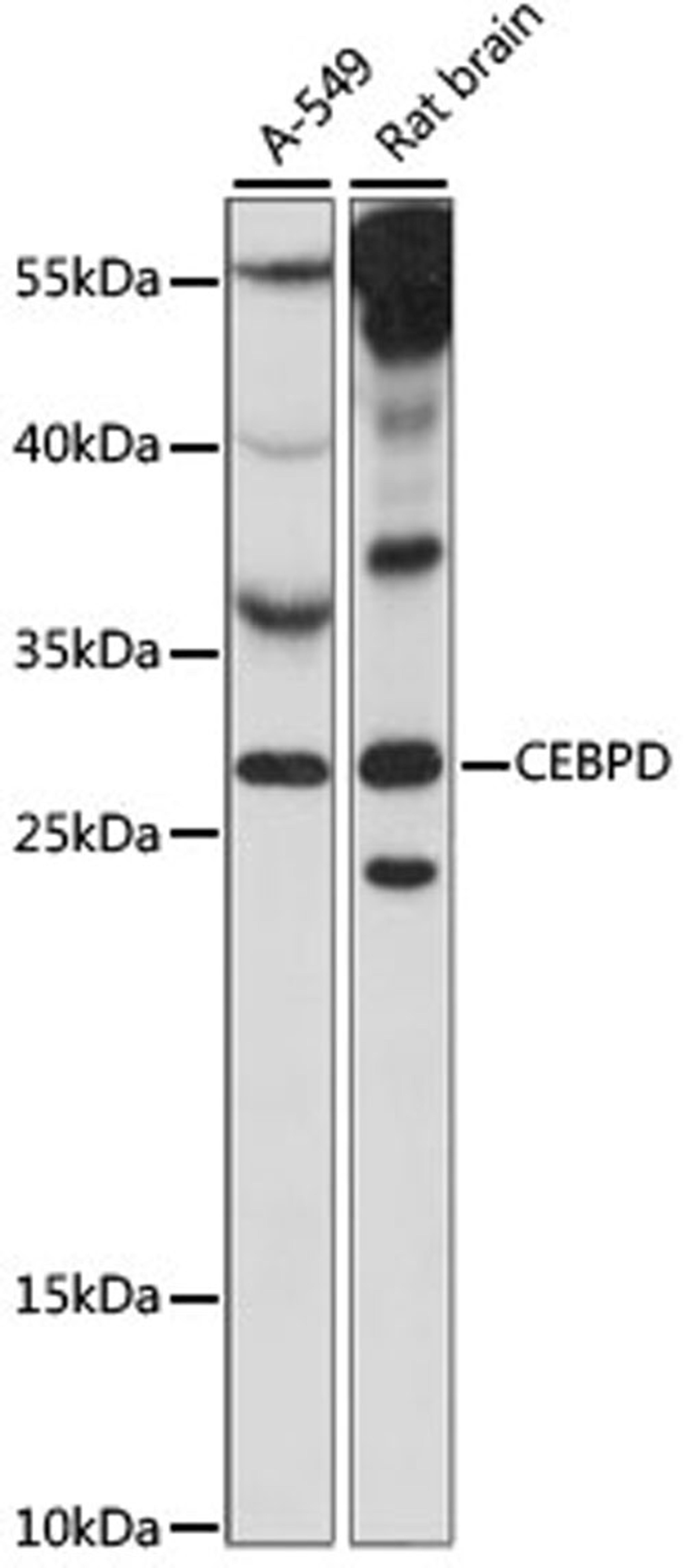 Western blot - CEBPD antibody (A15262)