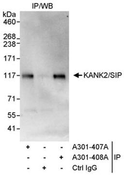 Detection of human KANK2/SIP by western blot of immunoprecipitates.