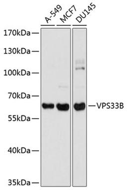 Western blot - VPS33B antibody (A8799)