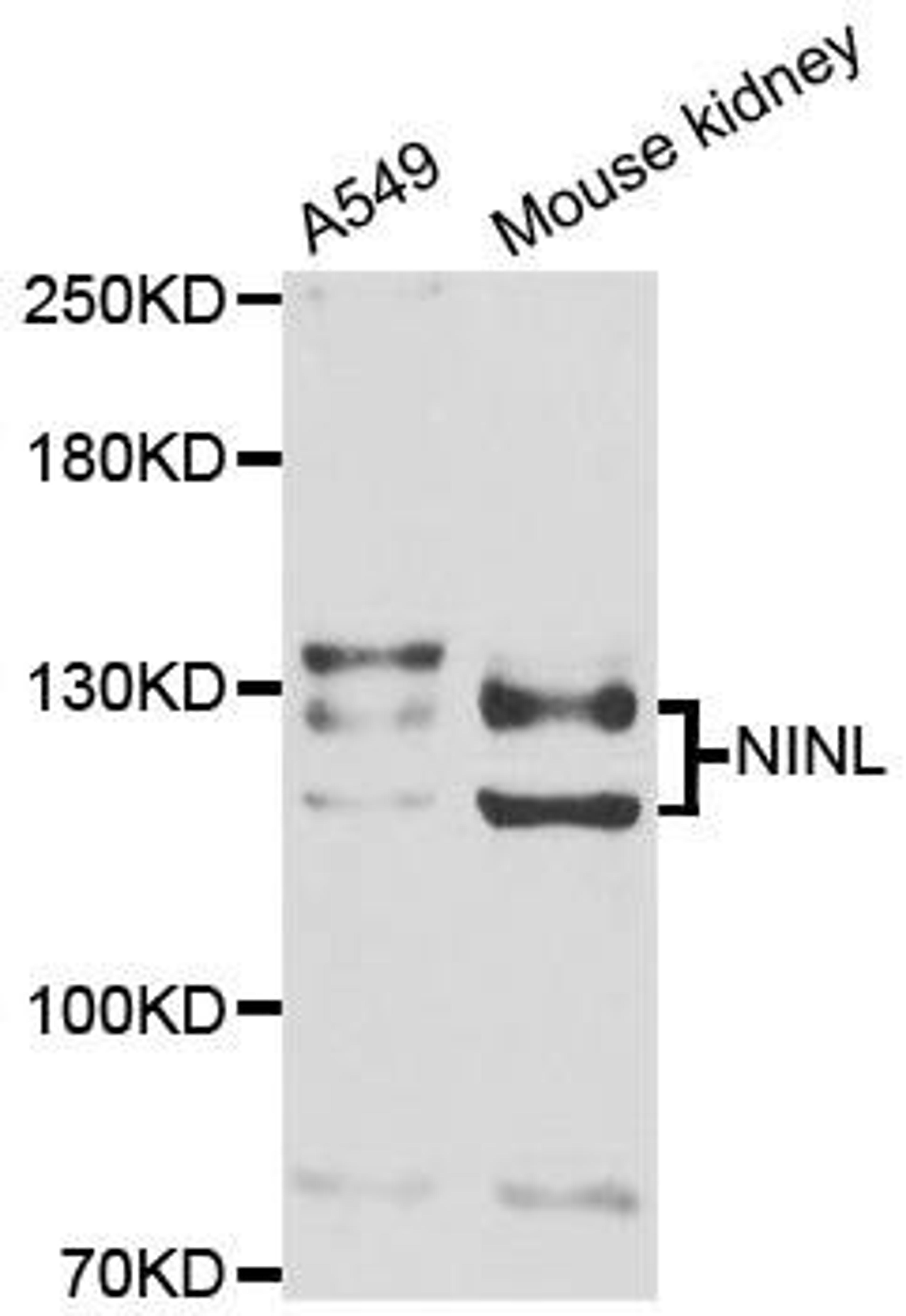 Western blot analysis of extracts of various cell lines using NINL antibody