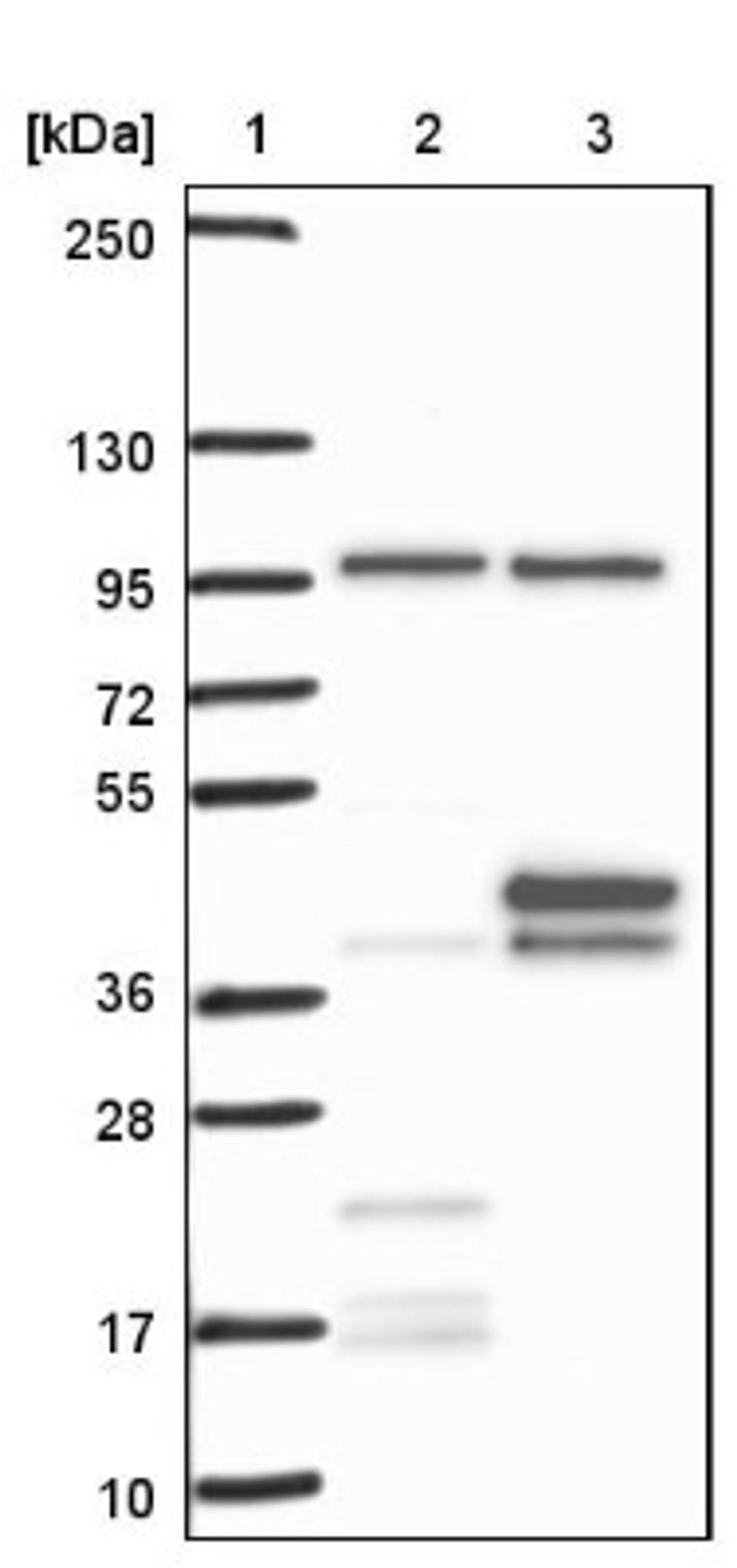 Western Blot: OCIAD1 Antibody [NBP1-92218] - Lane 1: Marker [kDa] 250, 130, 95, 72, 55, 36, 28, 17, 10<br/>Lane 2: Negative control (vector only transfected HEK293T lysate)<br/>Lane 3: Over-expression lysate (Co-expressed with a C-terminal myc-DDK tag (~3.1 kDa) in mammalian HEK293T cells, LY402620)