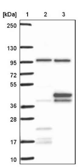 Western Blot: OCIAD1 Antibody [NBP1-92218] - Lane 1: Marker [kDa] 250, 130, 95, 72, 55, 36, 28, 17, 10<br/>Lane 2: Negative control (vector only transfected HEK293T lysate)<br/>Lane 3: Over-expression lysate (Co-expressed with a C-terminal myc-DDK tag (~3.1 kDa) in mammalian HEK293T cells, LY402620)