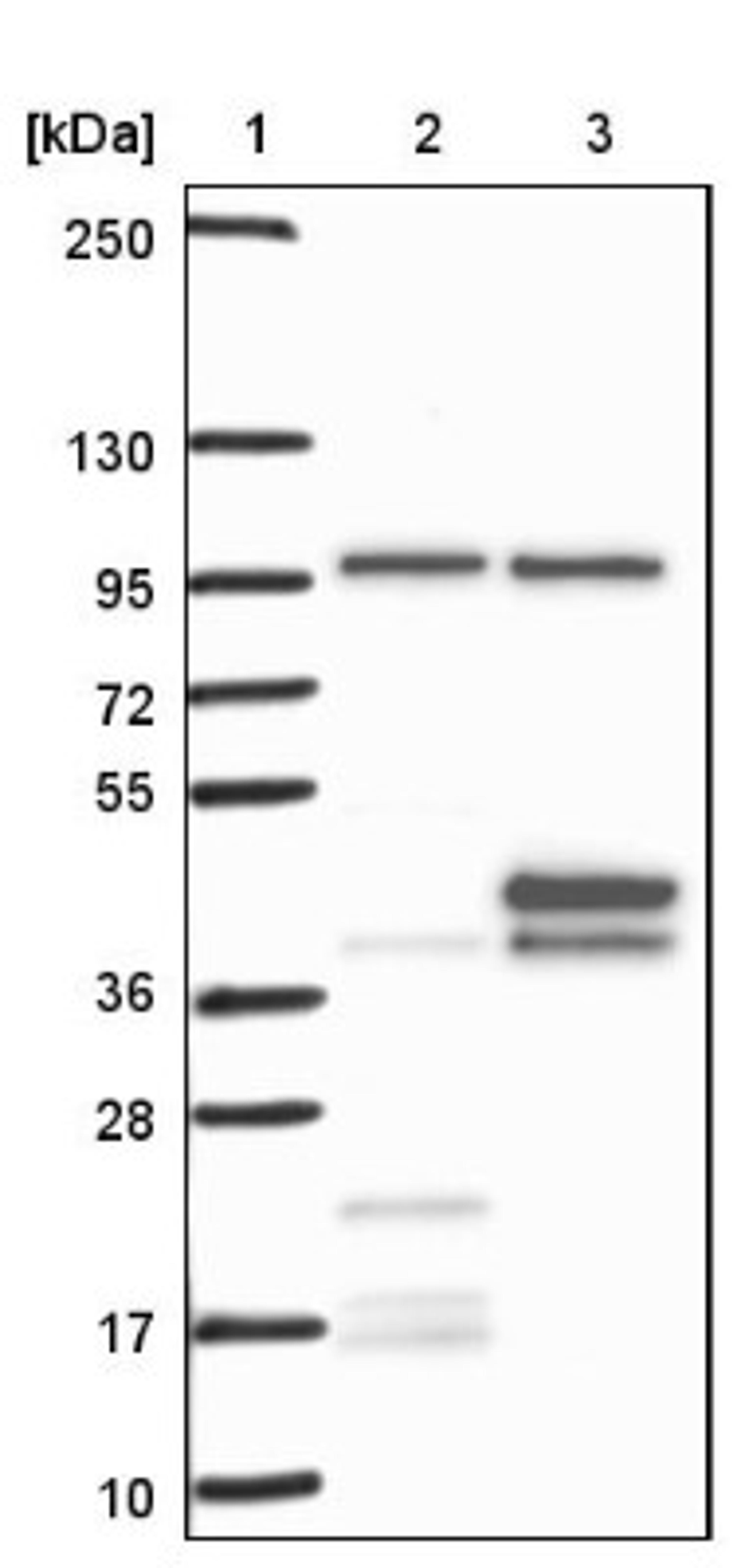 Western Blot: OCIAD1 Antibody [NBP1-92218] - Lane 1: Marker [kDa] 250, 130, 95, 72, 55, 36, 28, 17, 10<br/>Lane 2: Negative control (vector only transfected HEK293T lysate)<br/>Lane 3: Over-expression lysate (Co-expressed with a C-terminal myc-DDK tag (~3.1 kDa) in mammalian HEK293T cells, LY402620)