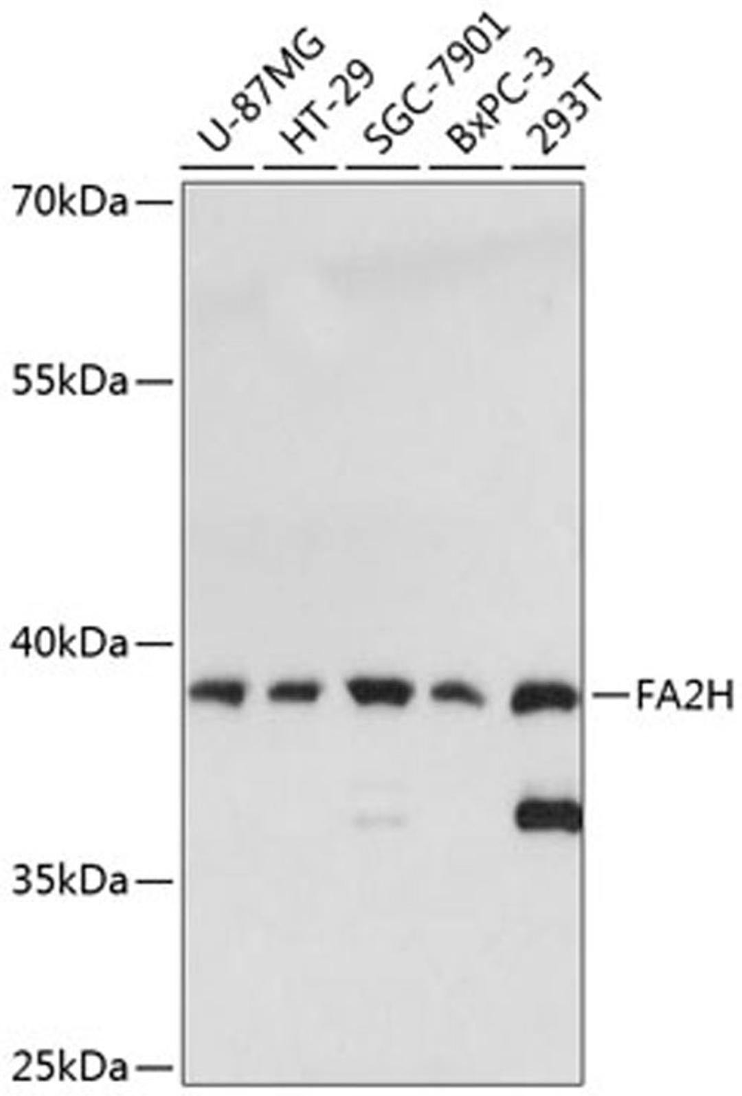 Western blot - FA2H antibody (A13873)