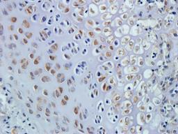Immunohistochemical staining of mouse bone marrow tissue using CTGF antibody (dilution of primary antibody - 2.5 ug/ml)