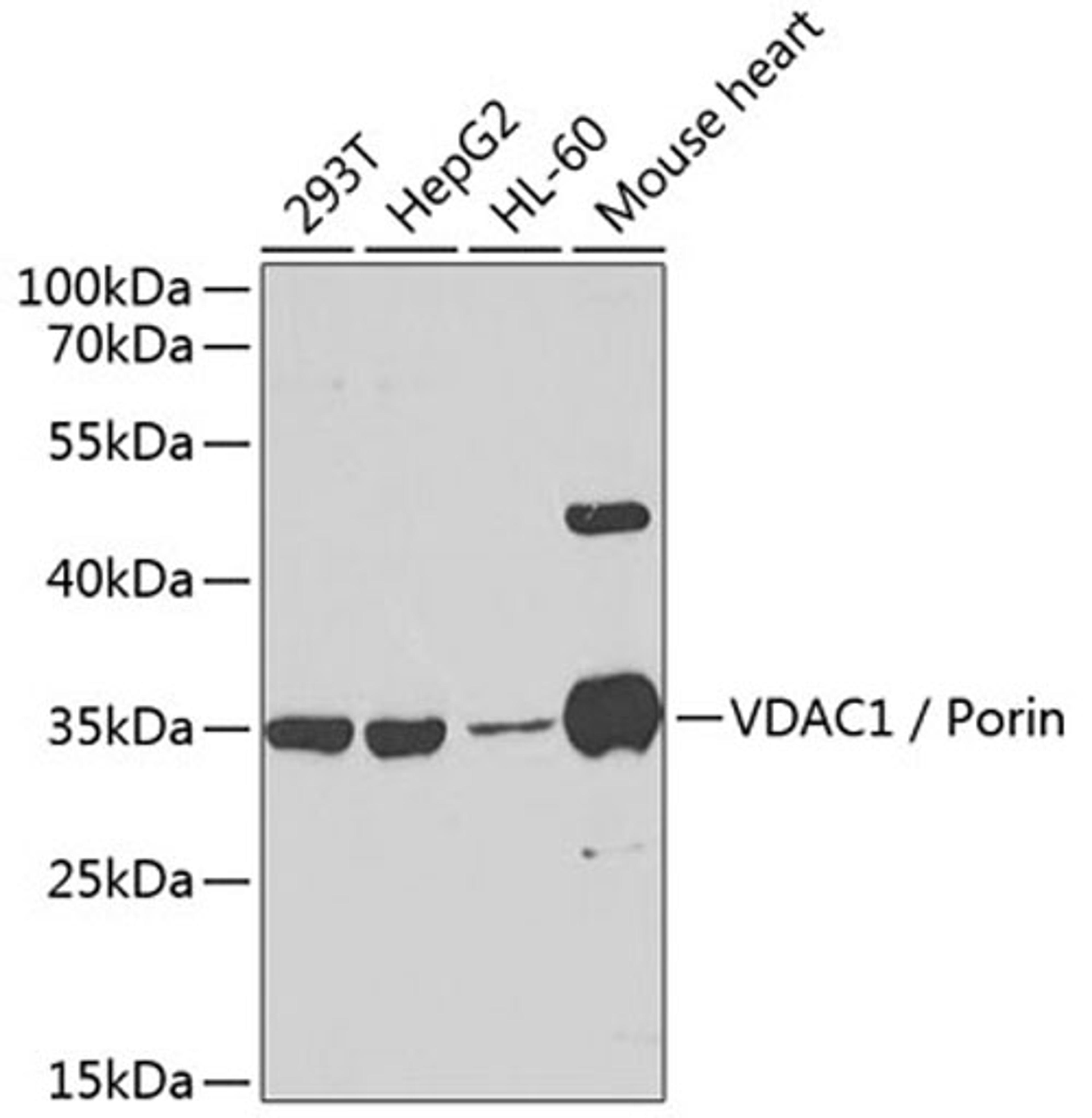 Western blot - VDAC1 / Porin antibody (A13638)