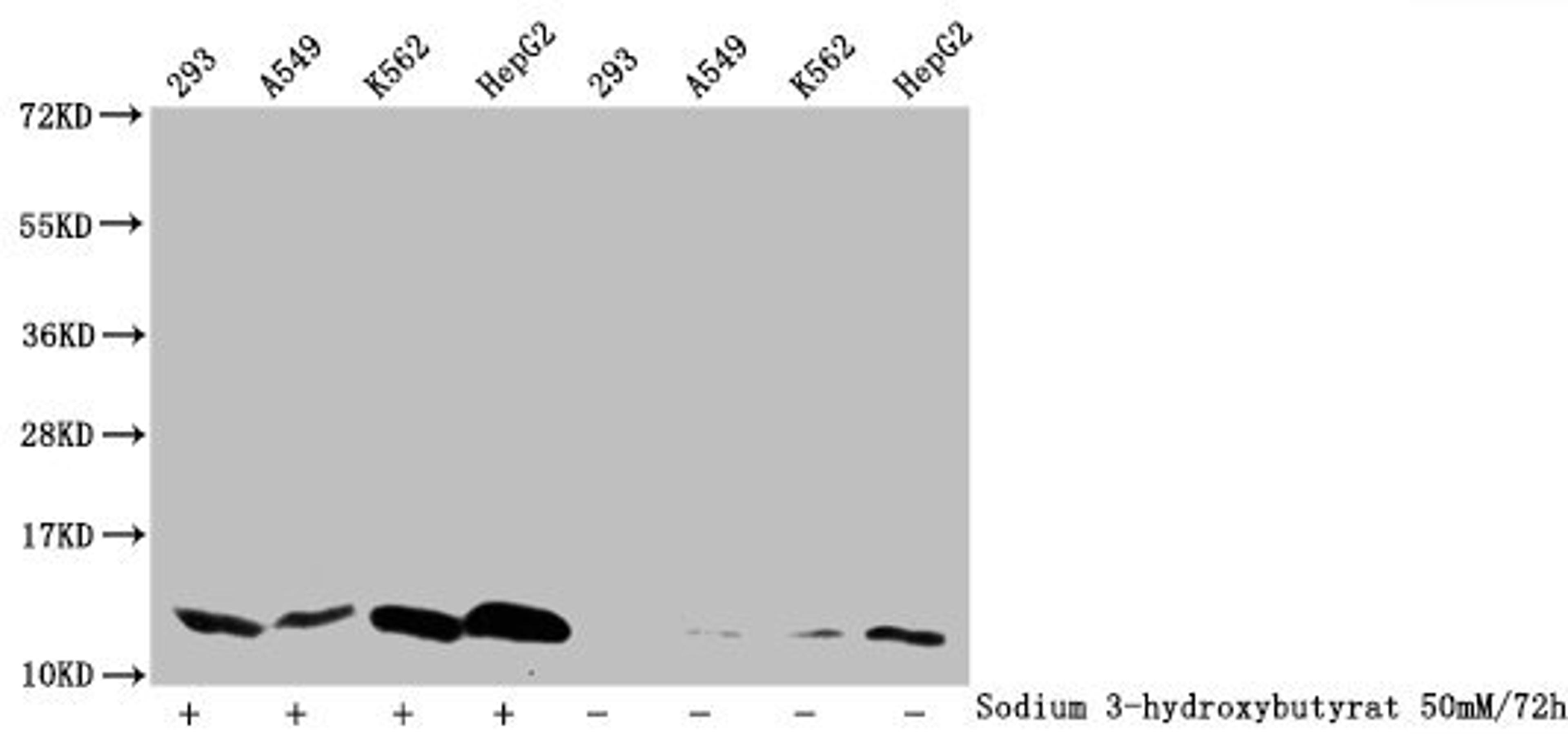 Western Blot. Detected samples: 293 whole cell lysate, A549 whole cell lysate, K562 whole cell lysate, HepG2 whole cell lysate; Untreated (-) or treated (+) with 50mM sodium 3-hydroxybutyrate for 72h. All lanes: HIST1H4A antibody at 1:1000. Secondary. Goat polyclonal to rabbit IgG at 1/40000 dilution. Predicted band size: 12 kDa. Observed band size: 12 kDa