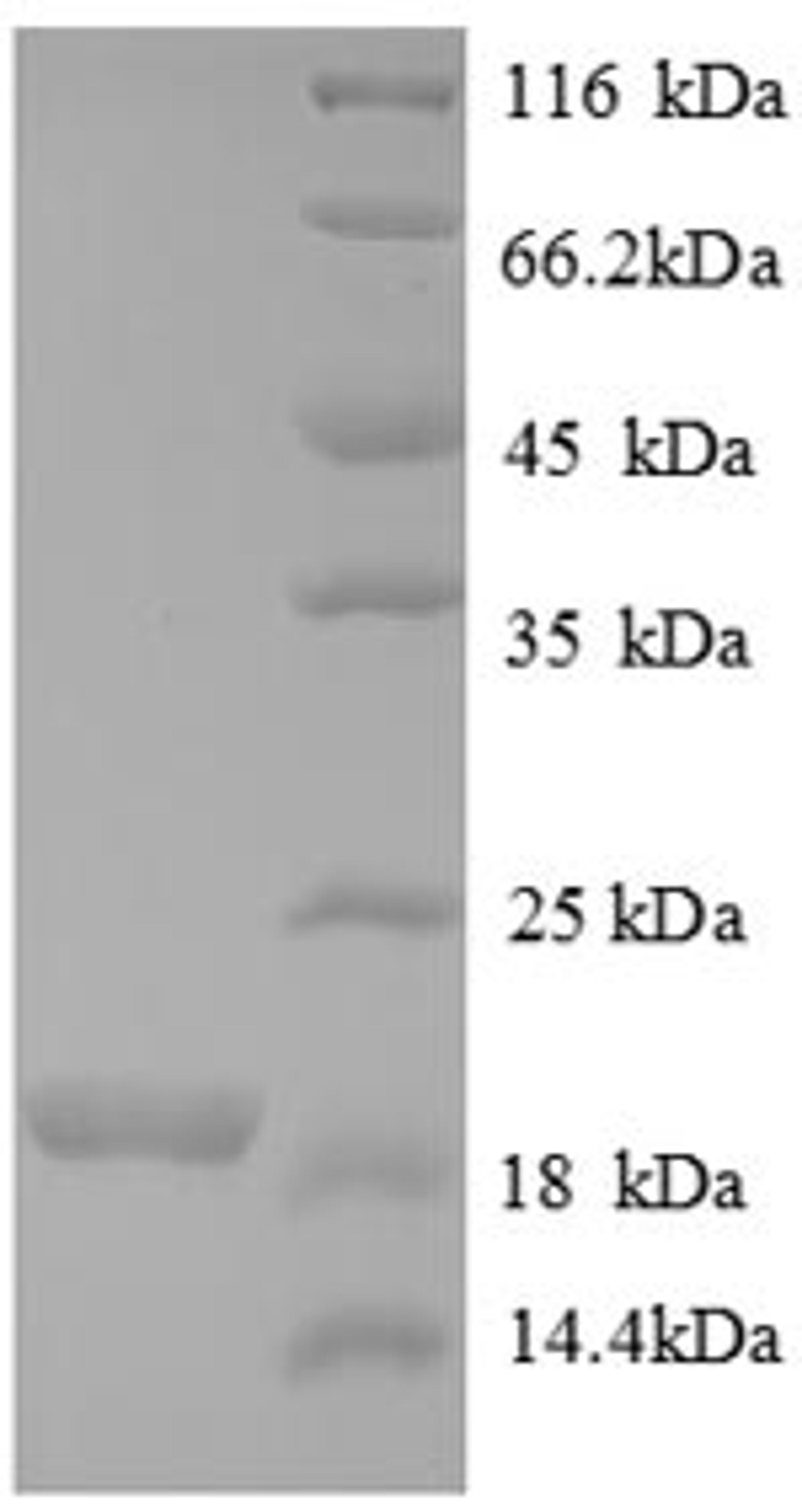 (Tris-Glycine gel) Discontinuous SDS-PAGE (reduced) with 5% enrichment gel and 15% separation gel.