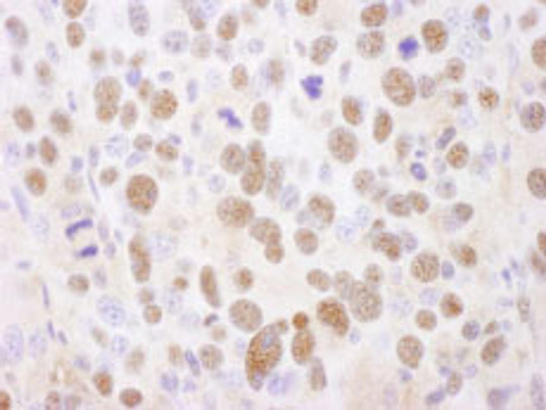 Detection of mouse PSMA2 by immunohistochemistry.