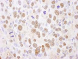 Detection of mouse PSMA2 by immunohistochemistry.