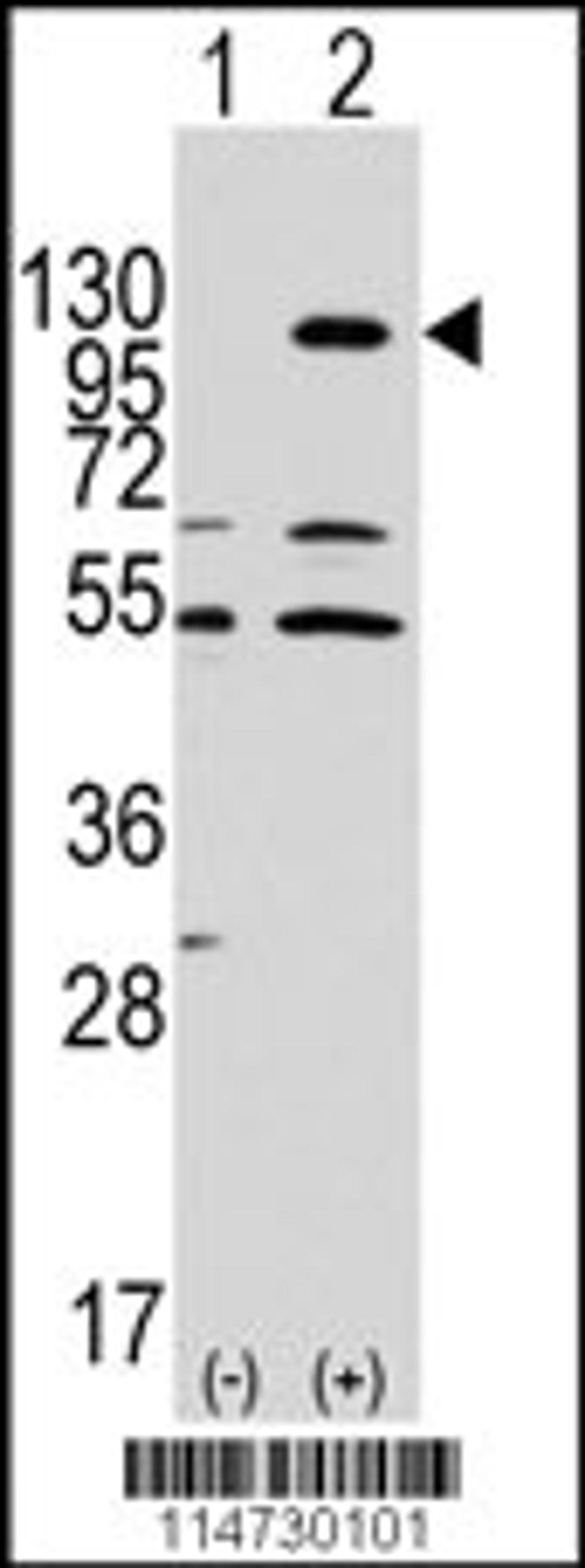 Western blot analysis of EphA7 using rabbit polyclonal EphA7 Antibody.293 cell lysates (2 ug/lane) either nontransfected (Lane 1) or transiently transfected with the EphA7 gene (Lane 2).