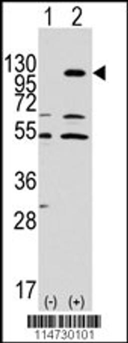 Western blot analysis of EphA7 using rabbit polyclonal EphA7 Antibody.293 cell lysates (2 ug/lane) either nontransfected (Lane 1) or transiently transfected with the EphA7 gene (Lane 2).