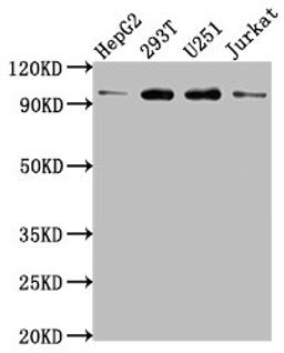 Western Blot. Positive WB detected in: HepG2 whole cell lysate, 293T whole cell lysate, U251 whole cell lysate, Jurkat whole cell lysate. All lanes: KPNB1 antibody at 1:2000. Secondary. Goat polyclonal to rabbit IgG at 1/50000 dilution. Predicted band size: 98, 82 kDa. Observed band size: 98 kDa. 