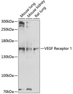 Western blot - VEGF Receptor 1 antibody (A1277)