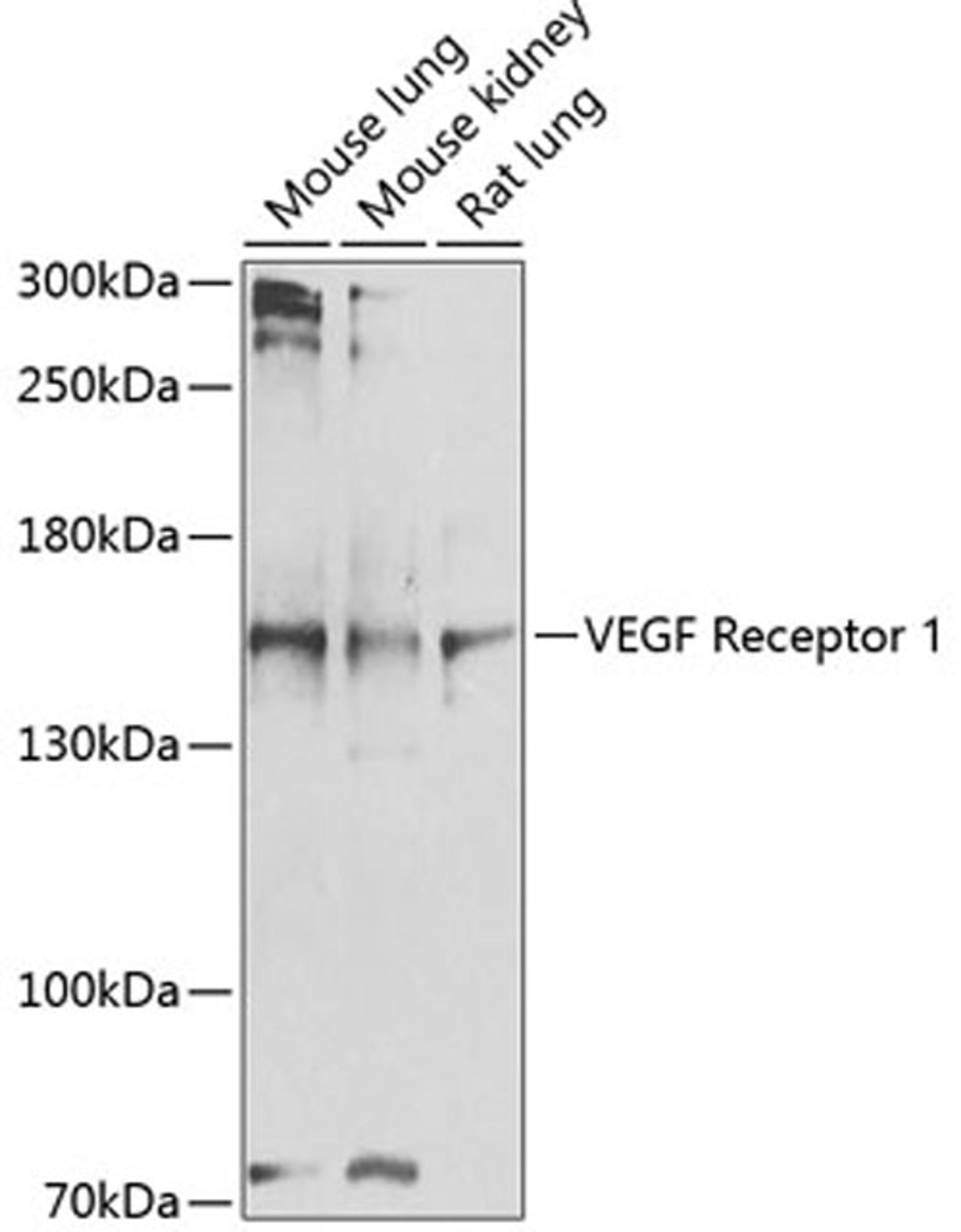 Western blot - VEGF Receptor 1 antibody (A1277)