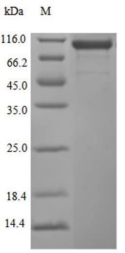 (Tris-Glycine gel) Discontinuous SDS-PAGE (reduced) with 5% enrichment gel and 15% separation gel.