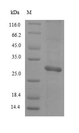 (Tris-Glycine gel) Discontinuous SDS-PAGE (reduced) with 5% enrichment gel and 15% separation gel.