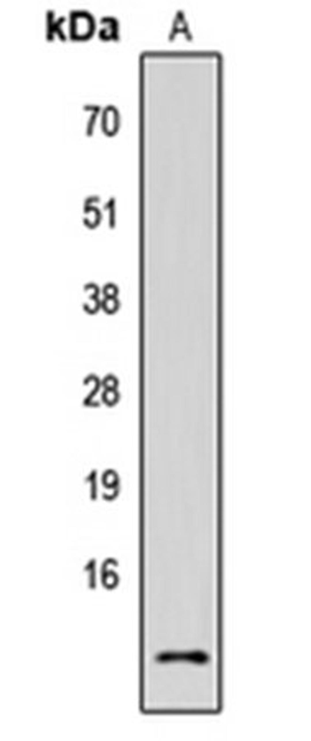 Western blot analysis of HEK293T (Lane 1) whole cell lysates using Fusion 1 antibody