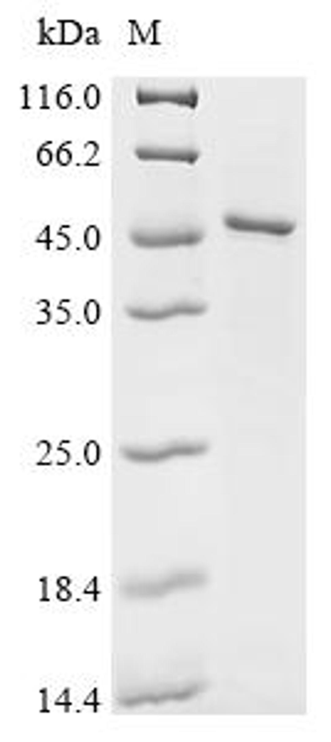 (Tris-Glycine gel) Discontinuous SDS-PAGE (reduced) with 5% enrichment gel and 15% separation gel.