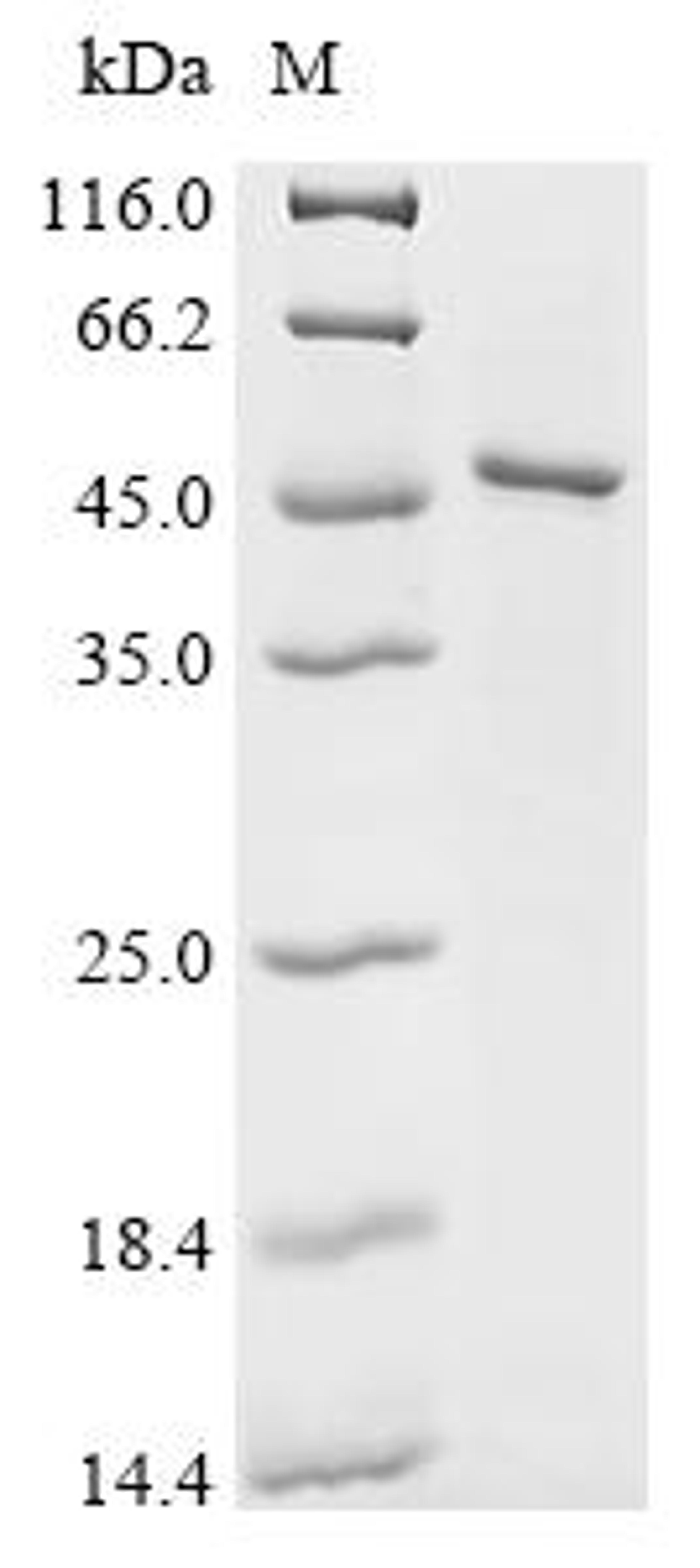(Tris-Glycine gel) Discontinuous SDS-PAGE (reduced) with 5% enrichment gel and 15% separation gel.
