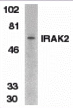 Western blot analysis of IRAK2 in K562 whole cell lysate with IRAK2 antibody at 1:500 dilution. 