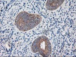 Immunohistochemistry-Paraffin: Ribophorin I Antibody (3H3) [NBP2-01294] - Staining of paraffin-embedded Human endometrium tissue using anti-Ribophorin I mouse monoclonal antibody.