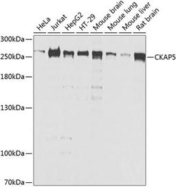 Western blot - CKAP5 antibody (A8532)